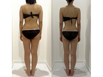 ヴィナーレ(VINARE)/痩身/全身キレイにサイズダウン