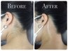 【女性限定】うなじ脱毛￥3,500→2,000