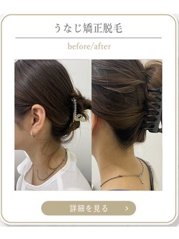 ミース 上野店/施術後のスッキリ感♪