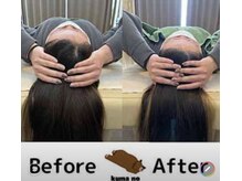 クマの冬眠 高知店/アタマほぐしでお顔もスッキリ