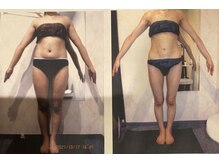 パーフェクトボディプレミアム 大阪難波店(PERFECT BODY PREMIUM)/お客様　ビフォーアフター（30）