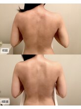 エムベル(M.belle)/ブライダルコース6回