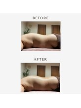 グランツ 小山店/インディバお腹集中施術