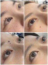 ネマウム(nemaum)/