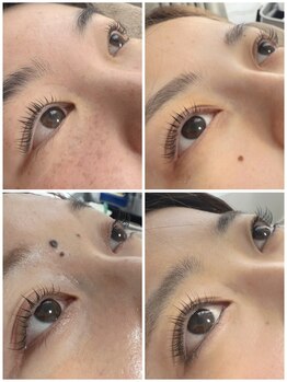 ネマウム(nemaum)/