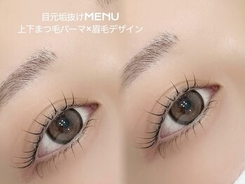 アイビューティー ロキエ 天王寺店(ROCHIE)/中顔面短縮メニュー