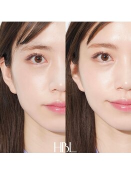 テンディ(TenD.)/【HBL】