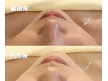 サロン ド マナ 神戸三宮店(salon de MANA)/ただあげるだけじゃない