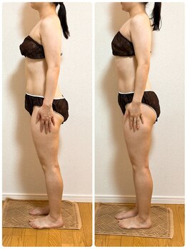 ソレイユ 北千住店(soleil)/ブライダルご希望のお客様（2）