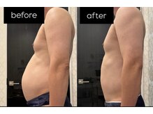 シャルム(CHARME)/インディバ