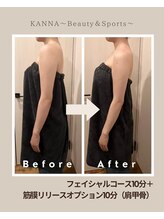 カンナ(KANNA)/肩こりにお悩みの方必見！！