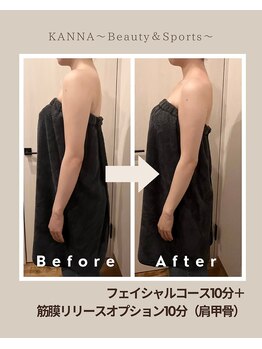 カンナ(KANNA)/肩こりにお悩みの方必見！！