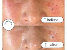 ユヌランコント 岐阜店(Une rencontre)/エンビロンエステ