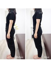 ジェイミープラス 表参道(J‘aimee +)/腰痛ビフォーアフター