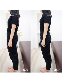 ジェイミープラス 表参道(J‘aimee +)/腰痛ビフォーアフター