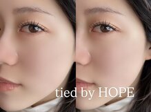 タイド バイ ホープ(tied by Hope)