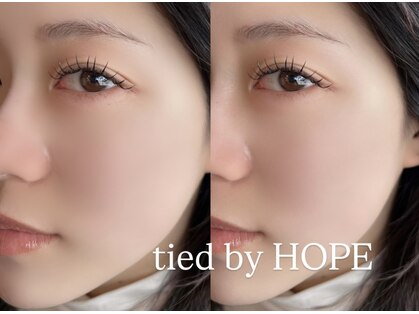 タイド バイ ホープ(tied by Hope)の写真