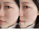タイド バイ ホープ(tied by Hope)の写真