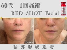 ナチュールファースト(naturel first)の雰囲気(素肌に自信が持てるノーファンデ肌へ導く☆フェイシャルメニュー)