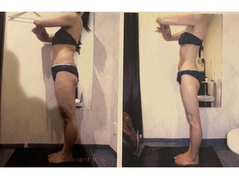 パーフェクトボディプレミアム 大阪難波店(PERFECT BODY PREMIUM)/お客様 ビフォーアフター(30)