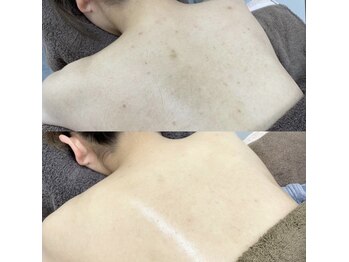 カルディエ(Cardie)/BODYハーブピーリング