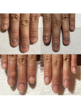 カンパニュラ(Campanula)/keep beautyコース