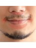 【ピンポイント脱毛】デザイン髭【男性】【回数：1回】