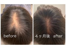 ルミア(LUMIA)の雰囲気(【幹細胞・エクソソーム導入】原液使用で短期間で効果を実感☆)