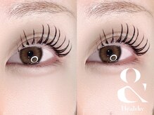 ミヨン(Miyon)/アンドヘルシー　140本