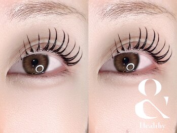 ミヨン(Miyon)/アンドヘルシー　140本