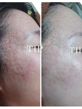 ソリッジ肌管理室/毛穴・赤ら顔・ニキビケア