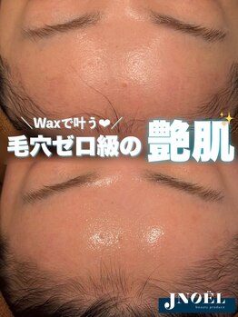 ジェノール 2nd beauty studio 姫路駅前店(JNOEL)/毛穴ゼロ級の艶肌！