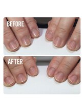 ネイルサロンスマイル(SMILE)/甘皮ケア