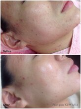 パールプラス 桑名店(Pearl plus)/before / after