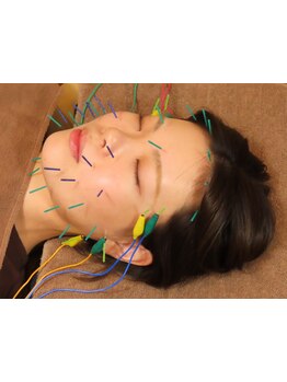 眼精疲労を解消したい