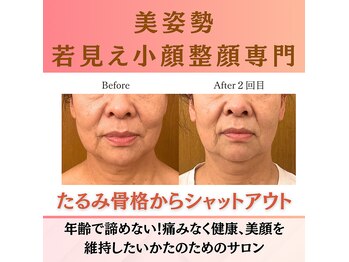 ウエルネスエステサロンジョー(Wellness Este Salon JO)
