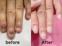 ネイル クロス ラニ 所沢店(Nail×Lani)/深爪矯正お任せ下さい♪