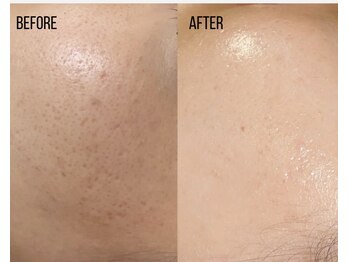 クラティス 伊那店(CRATIS)/ラミネーションピール