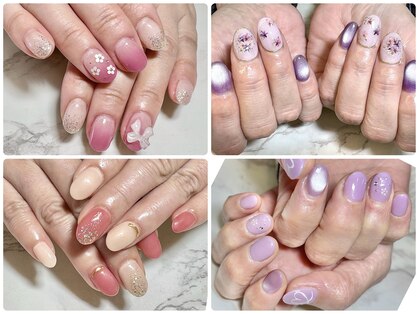 ゴールドエッグ(Gold Egg)の写真