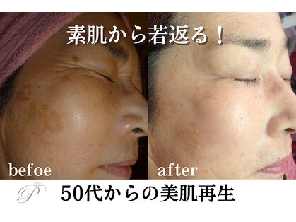 パールホワイトニングサロン 大船店の写真