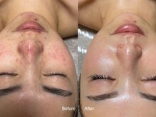 サロンドシー(SALON DE C)の雰囲気（肌質改善は根本からの改善を。症例写真はフォトギャラリーへ）
