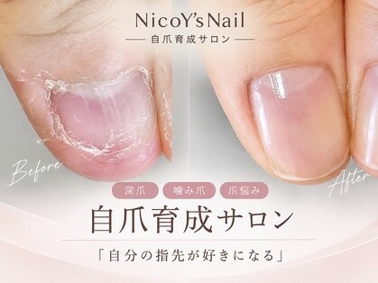 ニコワイズネイル(Nico Y's Nail)の写真