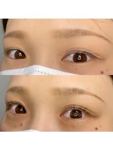 フィグ(fig)/ラッシュリフト