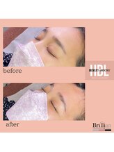 ブリリアン/美眉【ハリウッドブロウリフト】