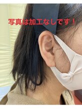 スナオダイエット けやき台(SunaoDiet)/耳つぼは貼っても目立ちにくい！