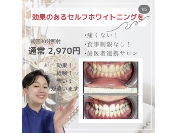 ライトビューティー 本八幡店(LIGHT BEAUTY)/芸能人さんの歯も担当♪