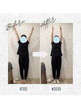 ラクリエ 東加古川院(La Creer)/お客様ビフォーアフター