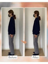 藤沢南口整体サロン/70代女性 全身矯正