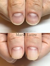マリーロール 淀屋橋本店(Marie Laure)/自爪育成/深爪矯正/ネイルケア