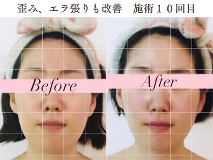 小顔コルギアンドフェイシャルサロン ジュエル(JEWEL)の写真